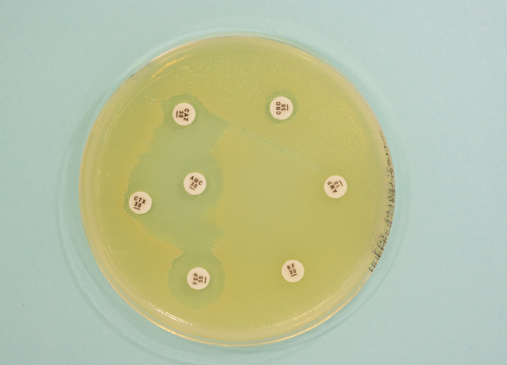 Capacidade do antibiograma detectar beta-lacmases e sua transmissão intra-hospitlar