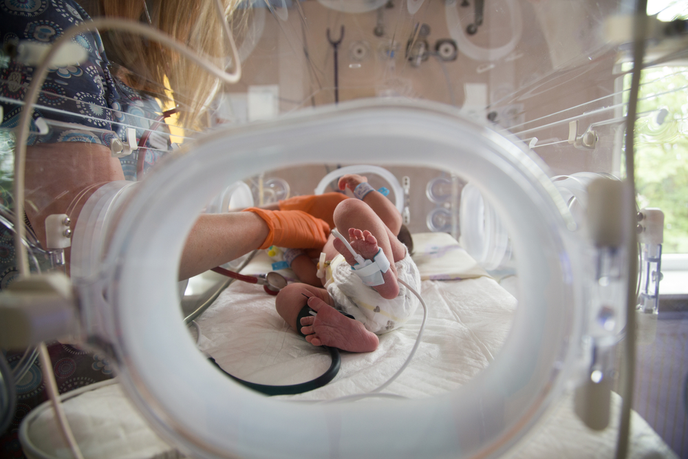 O diagnóstico de sepse e a antibioticoterapia empírica em UTI neonatal é um grande problema para CCIH em neonatologia. Esse estudo avalia a segurança da redução da duração da antibioticoterapia empírica em casos de suspeita de sepse neonatal precoce com hemocultura negativa. O paciente neonatal prematuro possui vários riscos importantes, entre os quais o desenvolvimento de sepse de início precoce já nos primeiros dias de vida.